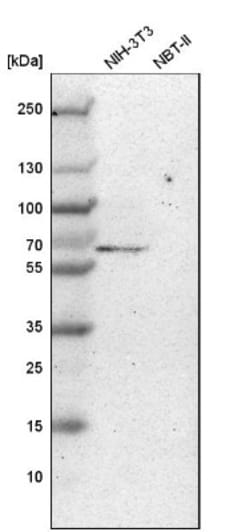 Carboxypeptidase M Antibody, Novus Biologicals:Antibodies:Primary Antibodies
